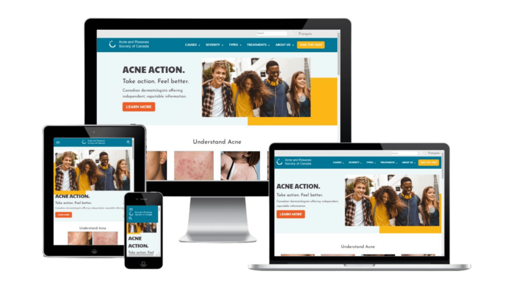 Various device screens displaying the Acne Action homepage with an image of a group of smiling teens.